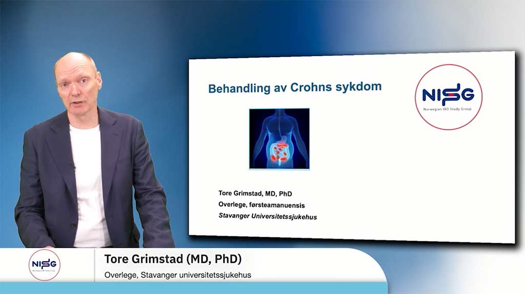 Tore Grimstad behandling av crohns sykdom